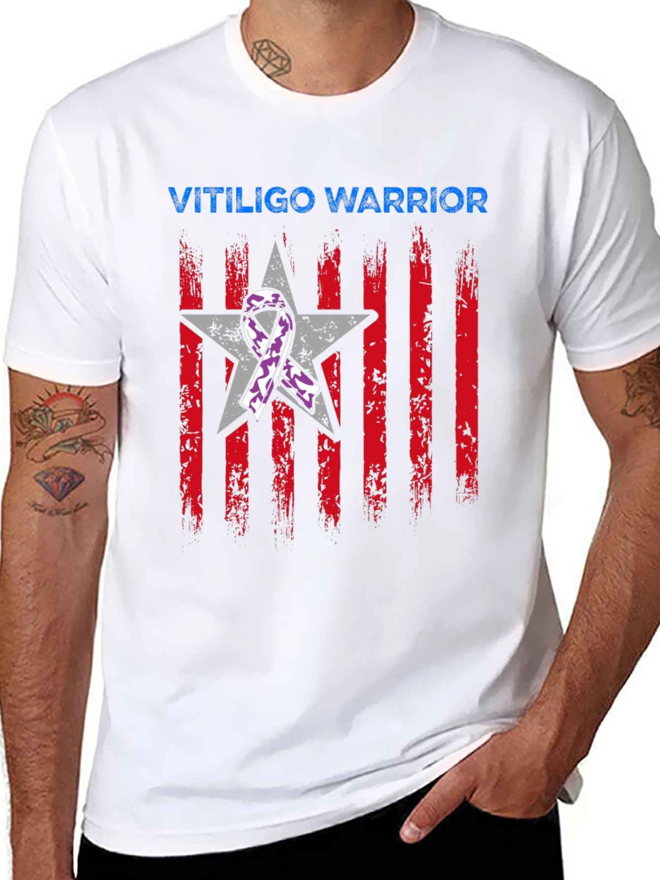 Vitiligo Warrior Graphic T-Shirt